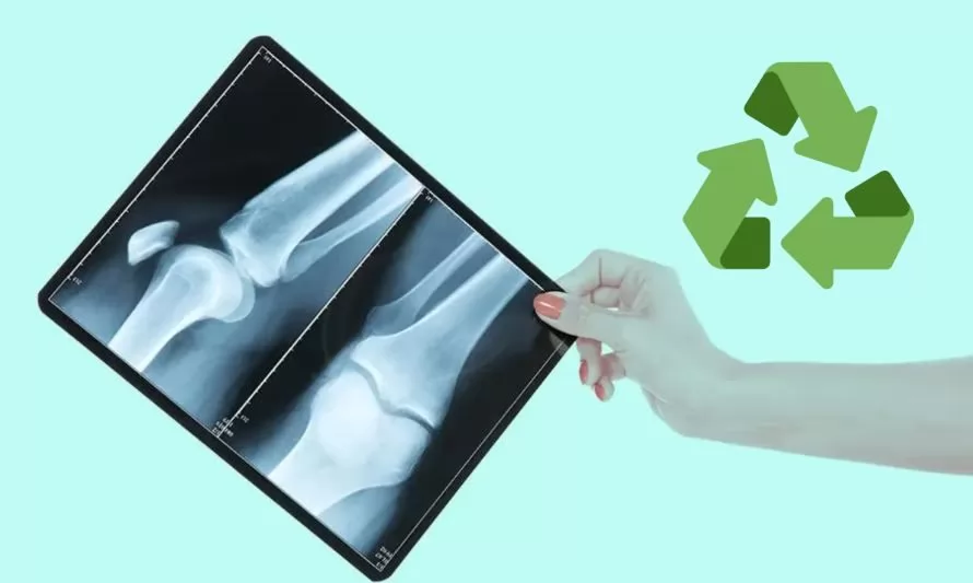 ¿Dónde se reciclan radiografías?